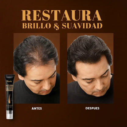 Esencia Anticaída de Cabello Regeneradora-Recupera el crecimiento capilar-🎁 50 % OFF